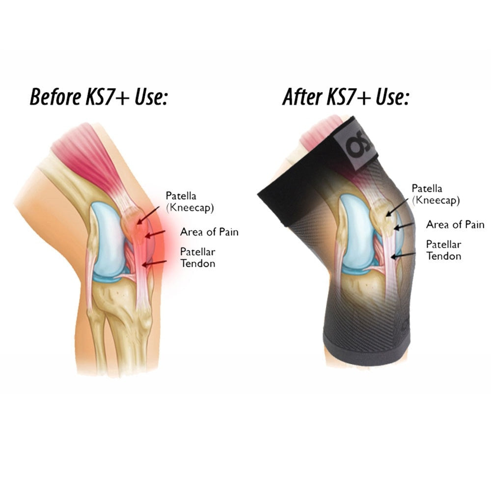 Pickleball OS1st  KS7+ Adjustable Performance Knee Sleeve